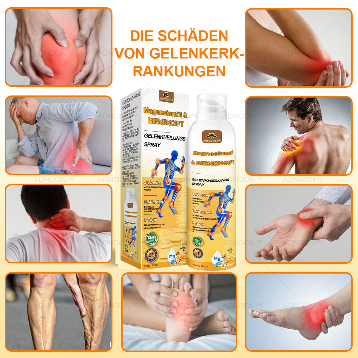 30upsell💧🐝ADNOON™ Magnesiumöl & Bienengift Gelenkheilungsspray 🏅👨‍⚕️