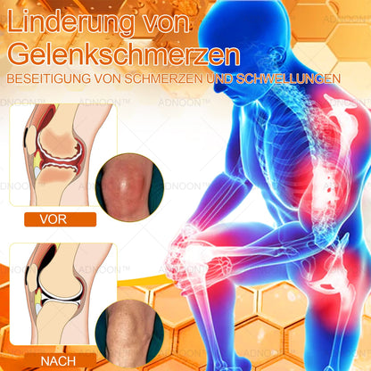 30upsell💧🐝ADNOON™ Magnesiumöl & Bienengift Gelenkheilungsspray 🏅👨‍⚕️